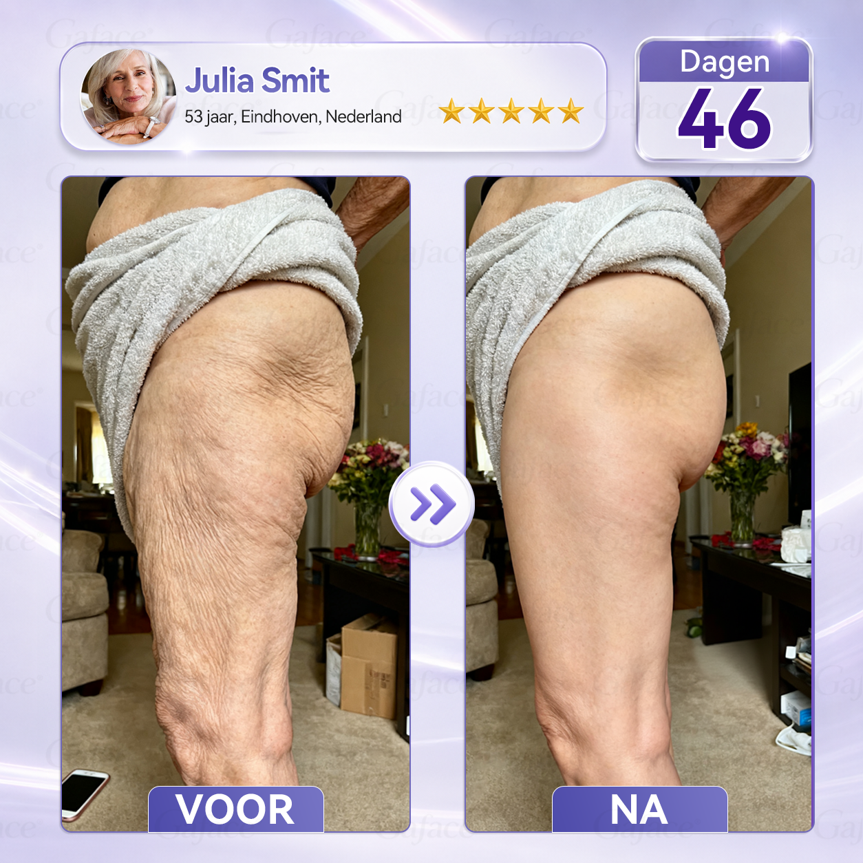 🌿 𝐆𝐚𝐟𝐚𝐜𝐞® 𝐂𝐨𝐥𝐥𝐚𝐠𝐞𝐞𝐧 & 𝐅𝐮𝐥𝐥𝐞𝐫𝐞𝐧𝐞𝐧 𝐕𝐞𝐫𝐬𝐭𝐞𝐯𝐢𝐠𝐞𝐧𝐝𝐞 𝐑𝐨𝐥𝐥𝐞𝐫𝐜𝐫è𝐦𝐞