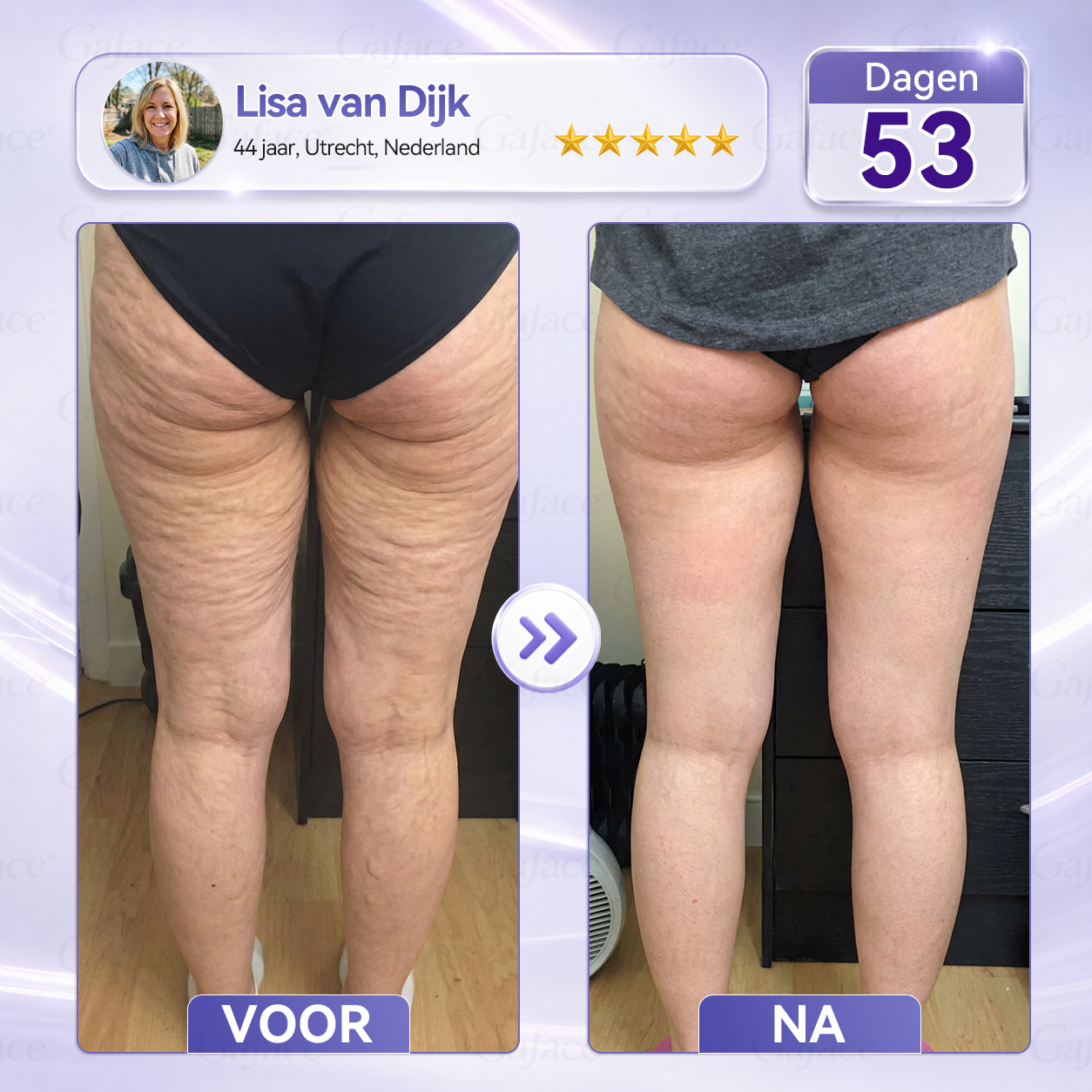 🌿 𝐆𝐚𝐟𝐚𝐜𝐞® 𝐂𝐨𝐥𝐥𝐚𝐠𝐞𝐞𝐧 & 𝐅𝐮𝐥𝐥𝐞𝐫𝐞𝐧𝐞𝐧 𝐕𝐞𝐫𝐬𝐭𝐞𝐯𝐢𝐠𝐞𝐧𝐝𝐞 𝐑𝐨𝐥𝐥𝐞𝐫𝐜𝐫è𝐦𝐞