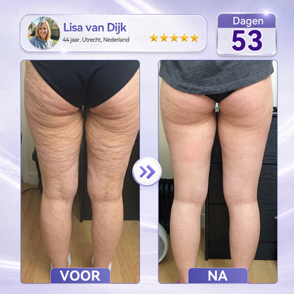 🌿 𝐆𝐚𝐟𝐚𝐜𝐞® 𝐂𝐨𝐥𝐥𝐚𝐠𝐞𝐞𝐧 & 𝐅𝐮𝐥𝐥𝐞𝐫𝐞𝐧𝐞𝐧 𝐕𝐞𝐫𝐬𝐭𝐞𝐯𝐢𝐠𝐞𝐧𝐝𝐞 𝐑𝐨𝐥𝐥𝐞𝐫𝐜𝐫è𝐦𝐞