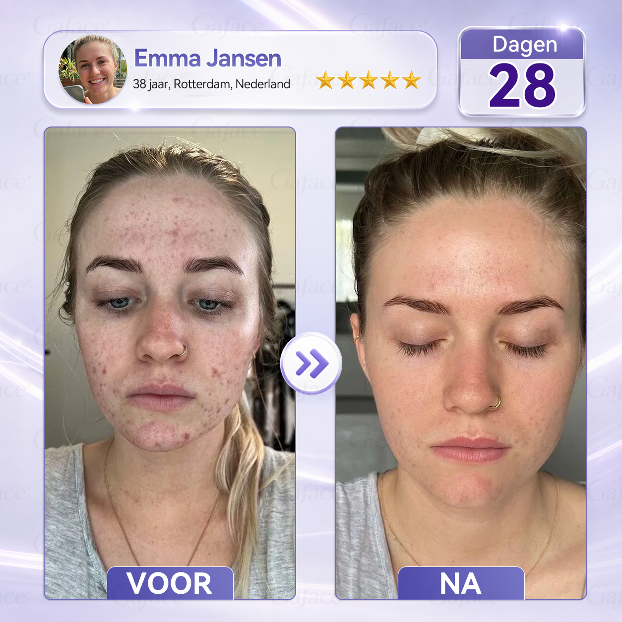 🌿 𝐆𝐚𝐟𝐚𝐜𝐞® 𝐂𝐨𝐥𝐥𝐚𝐠𝐞𝐞𝐧 & 𝐅𝐮𝐥𝐥𝐞𝐫𝐞𝐧𝐞𝐧 𝐕𝐞𝐫𝐬𝐭𝐞𝐯𝐢𝐠𝐞𝐧𝐝𝐞 𝐑𝐨𝐥𝐥𝐞𝐫𝐜𝐫è𝐦𝐞