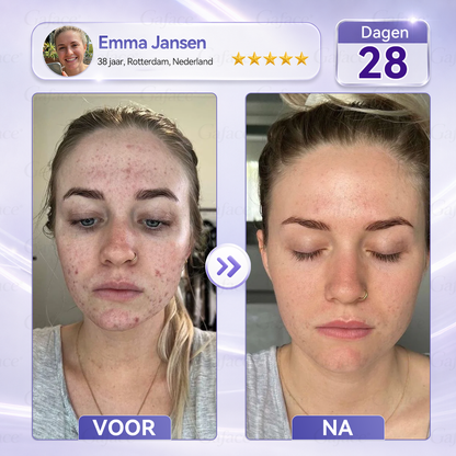 🌿 𝐆𝐚𝐟𝐚𝐜𝐞® 𝐂𝐨𝐥𝐥𝐚𝐠𝐞𝐞𝐧 & 𝐅𝐮𝐥𝐥𝐞𝐫𝐞𝐧𝐞𝐧 𝐕𝐞𝐫𝐬𝐭𝐞𝐯𝐢𝐠𝐞𝐧𝐝𝐞 𝐑𝐨𝐥𝐥𝐞𝐫𝐜𝐫è𝐦𝐞