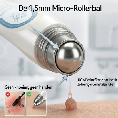 Officiële merk winkel |🔥𝐏i𝐜𝐝o® 7-DAGEN Wratten & Plekjes Verwijderaar (Pijnloos, littekenvrij rollerbal-applicator)💎