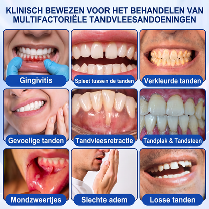 Glimmerly® 🎋🌳GUMREVIVE PERIODONTAAL REPARATIEGEL