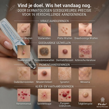 Officiële merk winkel |🔥𝐏i𝐜𝐝o® 7-DAGEN Wratten & Plekjes Verwijderaar (Pijnloos, littekenvrij rollerbal-applicator)💎