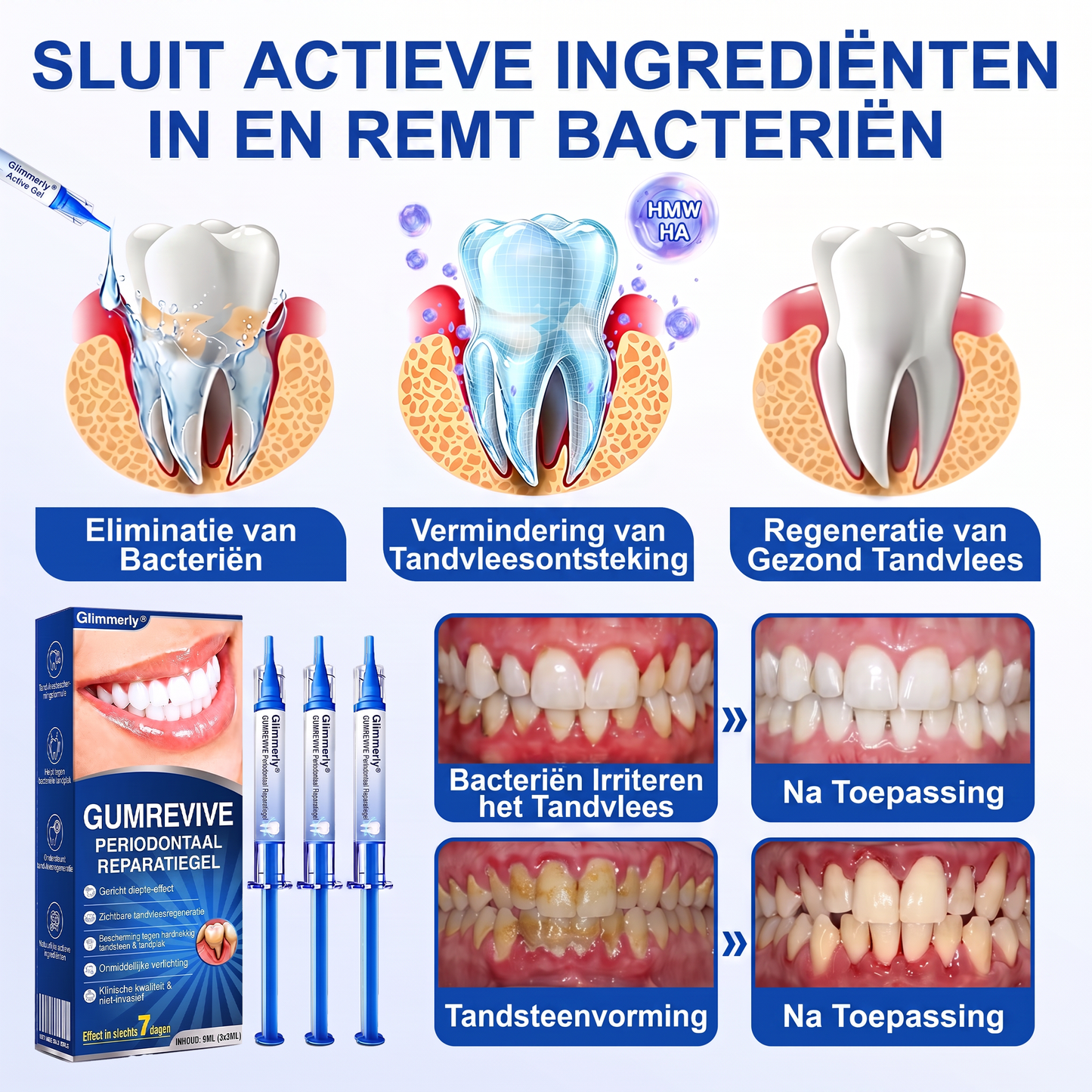 Glimmerly® 🎋🌳GUMREVIVE PERIODONTAAL REPARATIEGEL