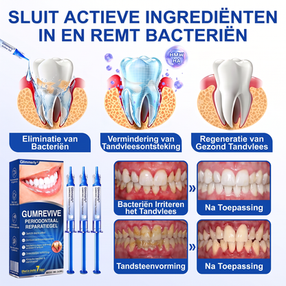 Glimmerly® 🎋🌳GUMREVIVE PERIODONTAAL REPARATIEGEL