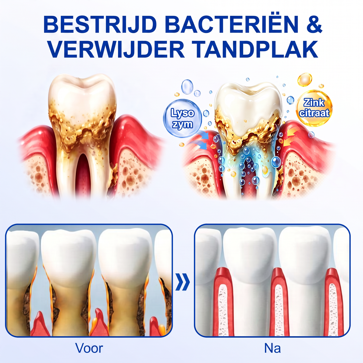 Glimmerly® 🎋🌳GUMREVIVE PERIODONTAAL REPARATIEGEL