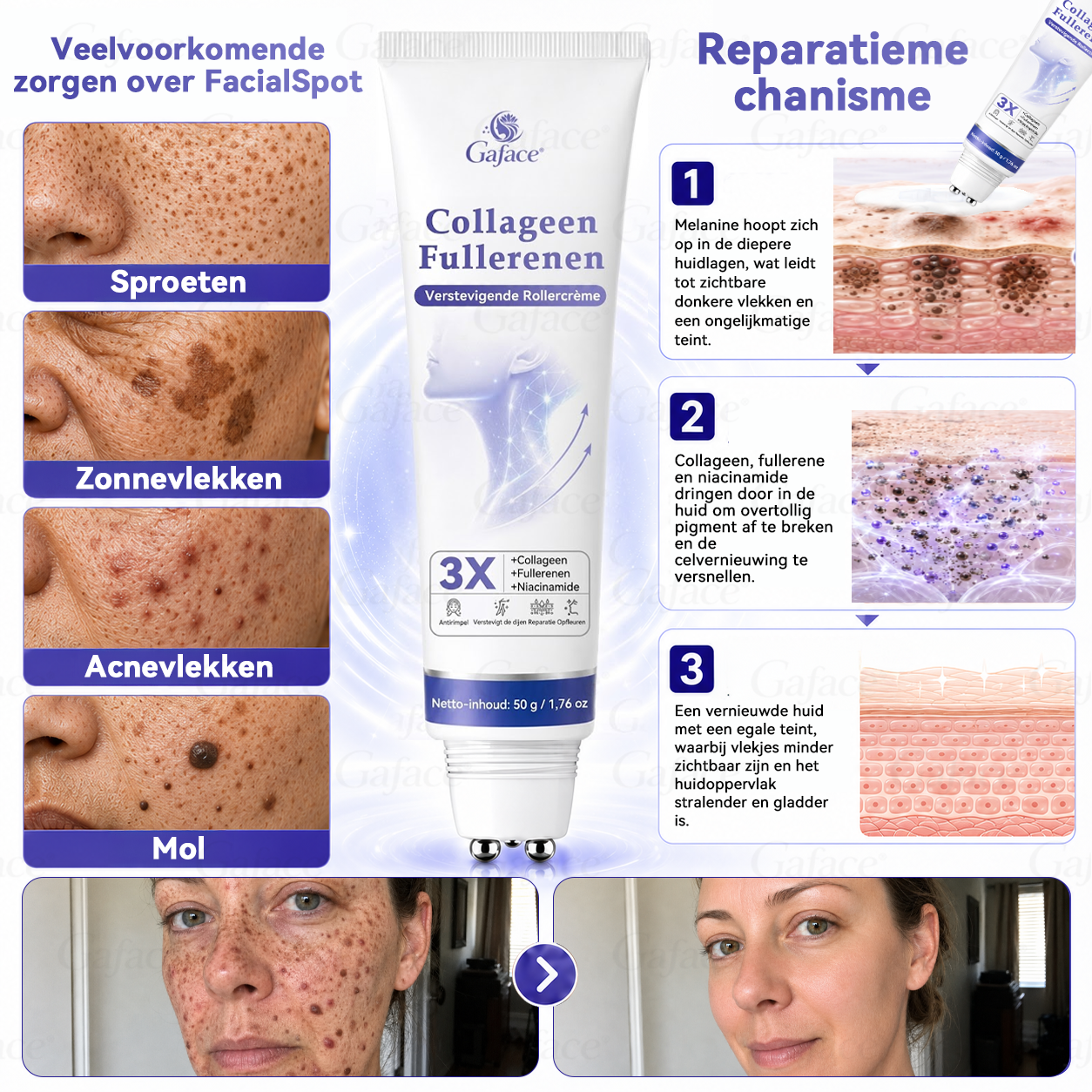 🌿 𝐆𝐚𝐟𝐚𝐜𝐞® 𝐂𝐨𝐥𝐥𝐚𝐠𝐞𝐞𝐧 & 𝐅𝐮𝐥𝐥𝐞𝐫𝐞𝐧𝐞𝐧 𝐕𝐞𝐫𝐬𝐭𝐞𝐯𝐢𝐠𝐞𝐧𝐝𝐞 𝐑𝐨𝐥𝐥𝐞𝐫𝐜𝐫è𝐦𝐞