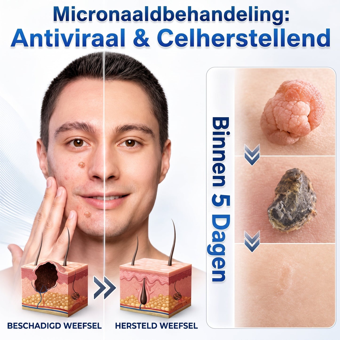 👩‍⚕️🥇 𝑂𝑓𝑓𝑖𝑐𝑖ë𝑙𝑒 𝑊𝑖𝑛𝑘𝑒𝑙 | 𝑵𝐞𝒌𝐢𝐬𝐬®  𝑴𝒊𝒄𝒓𝒐𝒏𝒂𝒂𝒍𝒅 𝑽𝒍𝒆𝒌𝒌𝒆𝒍𝒐𝒛𝒆 𝑯𝒖𝒊𝒅 𝑾𝒓𝒂𝒕𝒕𝒆𝒏 𝑽𝒆𝒓𝒘𝒊𝒋𝒅𝒆𝒓𝒆𝒏 𝑷𝒍𝒆𝒊𝒔𝒕𝒆𝒓 (𝑉𝑜𝑜𝑟 ℎ𝑢𝑖𝑑𝑓𝑙𝑎𝑝𝑗𝑒𝑠, 𝑘𝑙𝑒𝑖𝑛𝑒 ℎ𝑢𝑖𝑑𝑔𝑟𝑜𝑒𝑖𝑠𝑒𝑙𝑠, 𝑤𝑟𝑎𝑡𝑡𝑒𝑛, 𝑚𝑜𝑒𝑑𝑒𝑟𝑣𝑙𝑒𝑘𝑘𝑒𝑛, 𝑜𝑢𝑑𝑒𝑟𝑑𝑜𝑚𝑠𝑣𝑙𝑒𝑘𝑘𝑒𝑛 𝑒𝑛 𝑝𝑖𝑔𝑚𝑒𝑛𝑡𝑎𝑡𝑖𝑒𝑝𝑟𝑜𝑏𝑙𝑒𝑚𝑒𝑛)