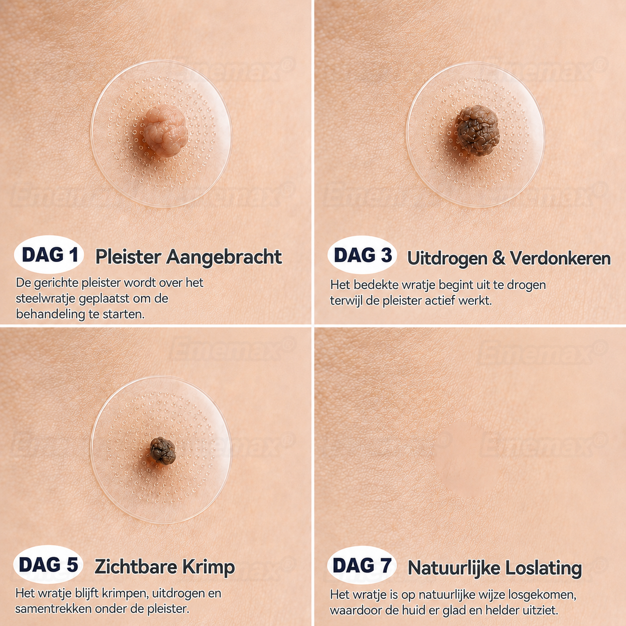 ✨👍𝐄𝐦𝐞𝐦𝐚𝐱®2 𝒊𝒏 1 𝑴𝒊𝒄𝒓𝒐-𝒏𝒂𝒂𝒍𝒅 & 𝑯𝒚𝒅𝒓𝒐𝒄𝒐𝒍𝒍𝒐ï𝒅 𝑴𝒐𝒆𝒅𝒆𝒓𝒗𝒍𝒆𝒌 𝑽𝒆𝒓𝒘𝒊𝒋𝒅𝒆𝒓𝒊𝒏𝒈 𝑷𝒍𝒆𝒊𝒔𝒕𝒆𝒓(𝑃𝑙𝑒𝑖𝑠𝑡𝑒𝑟 𝑧𝑜𝑛𝑑𝑒𝑟 𝑝𝑖𝑗𝑛, 𝑧𝑜𝑛𝑑𝑒𝑟 𝑙𝑖𝑡𝑡𝑒𝑘𝑒𝑛𝑠)