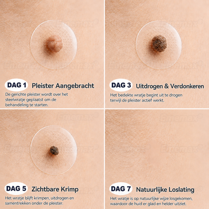 ✨👍𝐄𝐦𝐞𝐦𝐚𝐱®2 𝒊𝒏 1 𝑴𝒊𝒄𝒓𝒐-𝒏𝒂𝒂𝒍𝒅 & 𝑯𝒚𝒅𝒓𝒐𝒄𝒐𝒍𝒍𝒐ï𝒅 𝑴𝒐𝒆𝒅𝒆𝒓𝒗𝒍𝒆𝒌 𝑽𝒆𝒓𝒘𝒊𝒋𝒅𝒆𝒓𝒊𝒏𝒈 𝑷𝒍𝒆𝒊𝒔𝒕𝒆𝒓(𝑃𝑙𝑒𝑖𝑠𝑡𝑒𝑟 𝑧𝑜𝑛𝑑𝑒𝑟 𝑝𝑖𝑗𝑛, 𝑧𝑜𝑛𝑑𝑒𝑟 𝑙𝑖𝑡𝑡𝑒𝑘𝑒𝑛𝑠)
