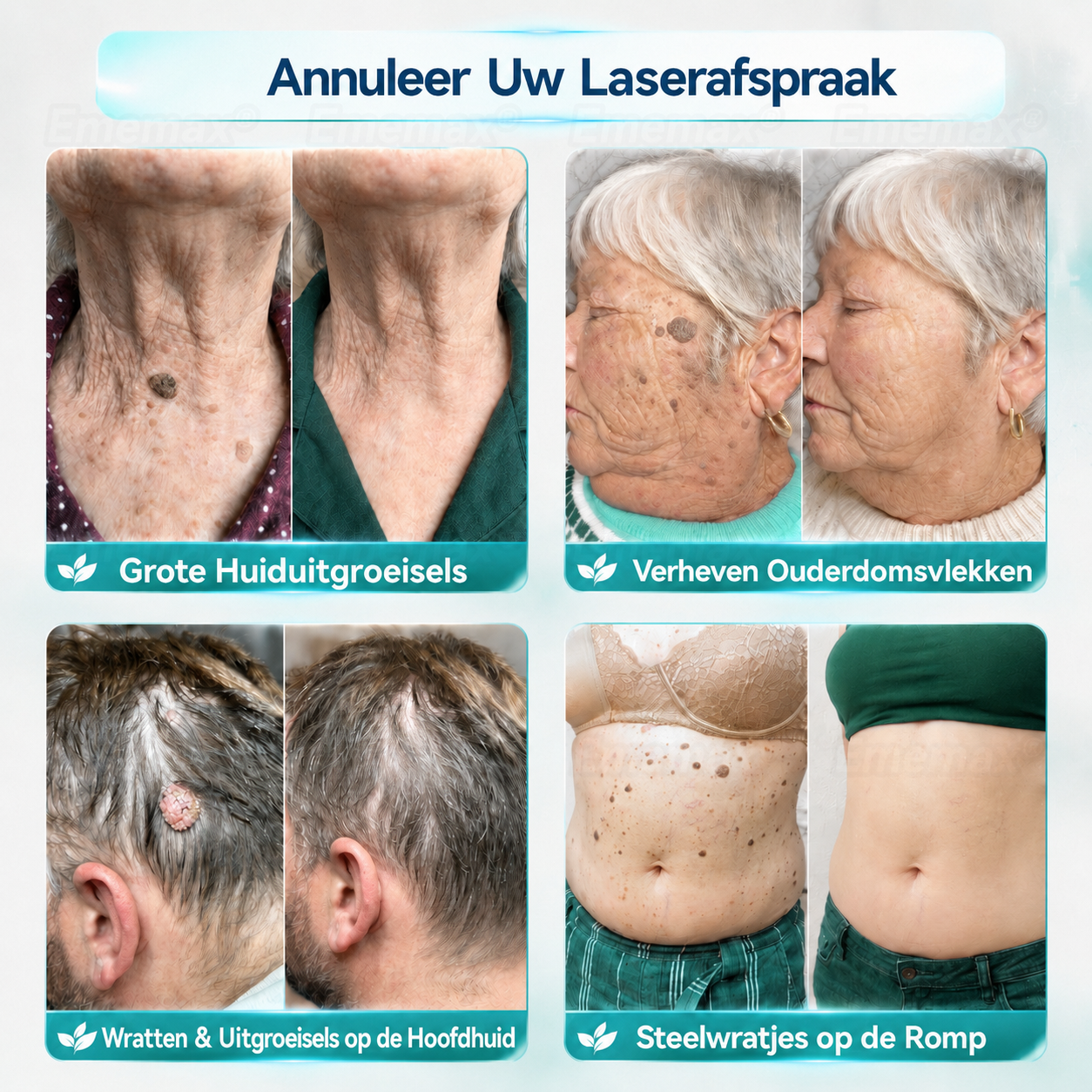 ✨👍𝐄𝐦𝐞𝐦𝐚𝐱®2 𝒊𝒏 1 𝑴𝒊𝒄𝒓𝒐-𝒏𝒂𝒂𝒍𝒅 & 𝑯𝒚𝒅𝒓𝒐𝒄𝒐𝒍𝒍𝒐ï𝒅 𝑴𝒐𝒆𝒅𝒆𝒓𝒗𝒍𝒆𝒌 𝑽𝒆𝒓𝒘𝒊𝒋𝒅𝒆𝒓𝒊𝒏𝒈 𝑷𝒍𝒆𝒊𝒔𝒕𝒆𝒓(𝑃𝑙𝑒𝑖𝑠𝑡𝑒𝑟 𝑧𝑜𝑛𝑑𝑒𝑟 𝑝𝑖𝑗𝑛, 𝑧𝑜𝑛𝑑𝑒𝑟 𝑙𝑖𝑡𝑡𝑒𝑘𝑒𝑛𝑠)